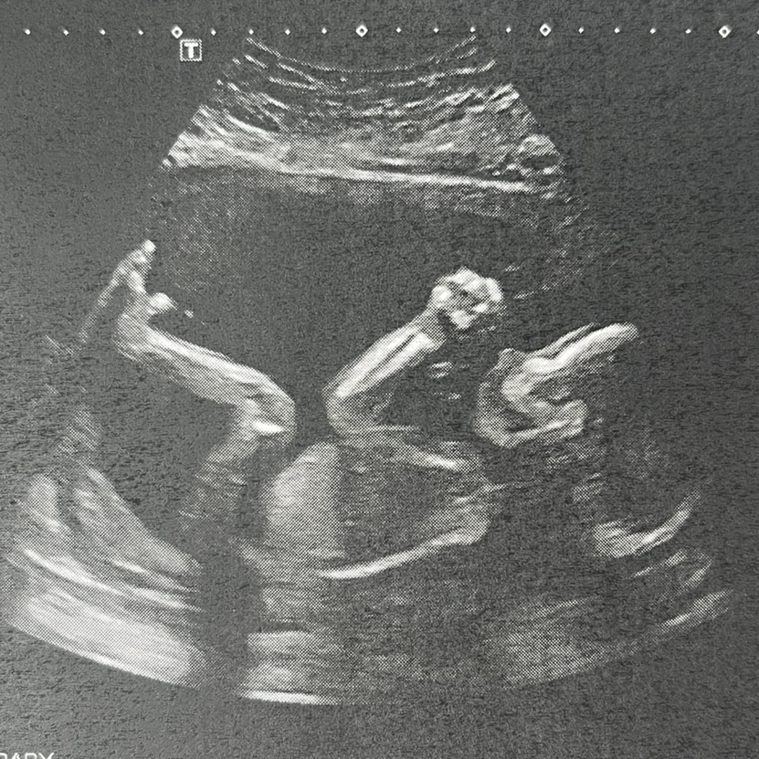 Photo shared by Alexiss for their Babylist baby registry.