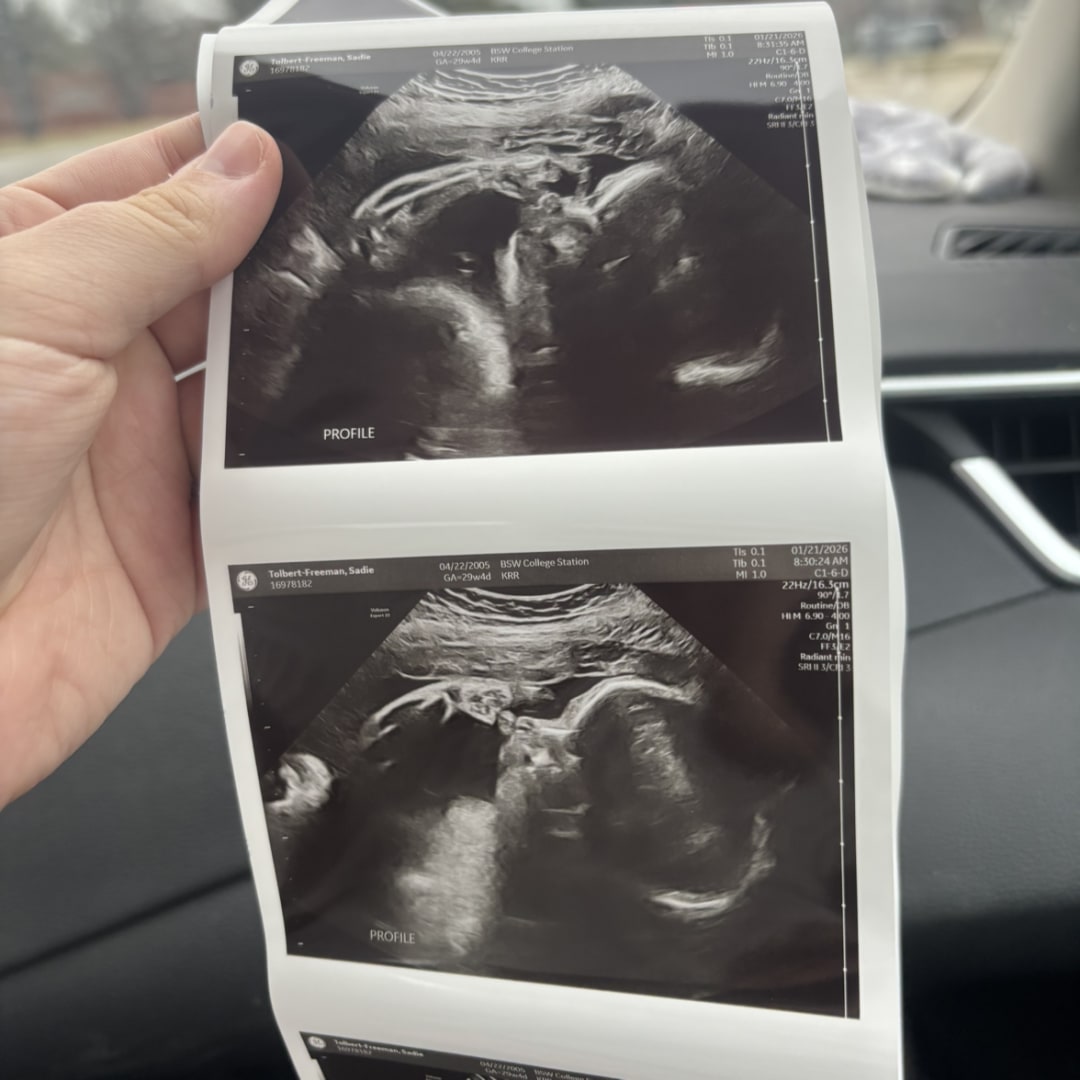 Photo shared by Sadie for their Babylist baby registry.