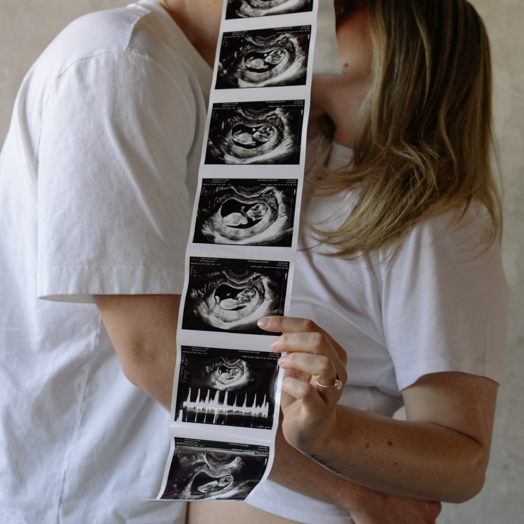 Photo shared by Elle for their Babylist baby registry.