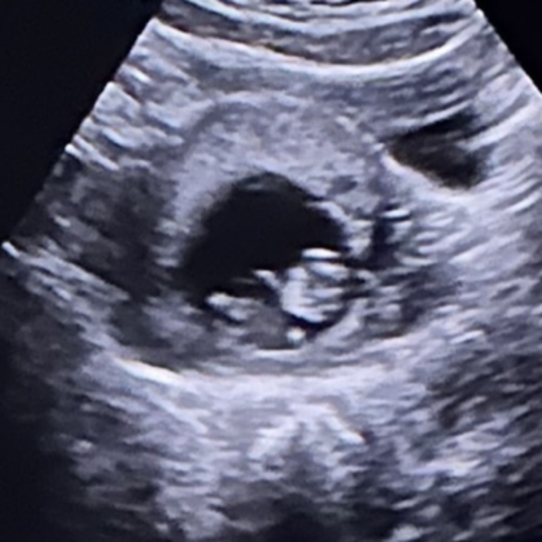 Photo shared by Jake for their Babylist baby registry.