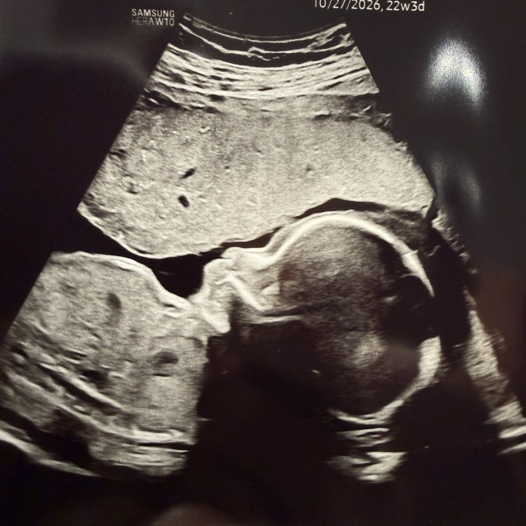 Photo shared by Laurel for their Babylist baby registry.