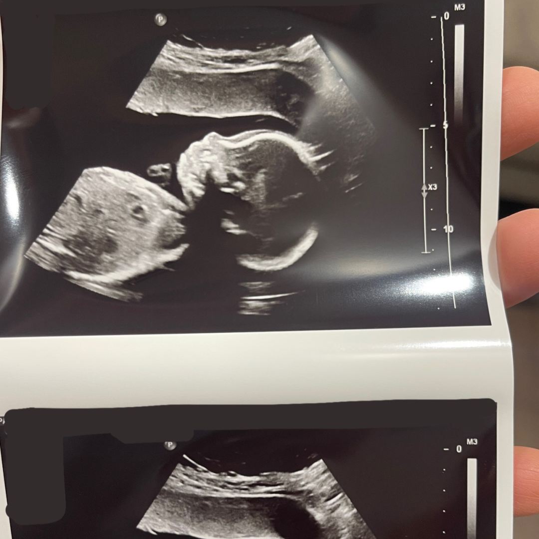Photo shared by Jessica for their Babylist baby registry.