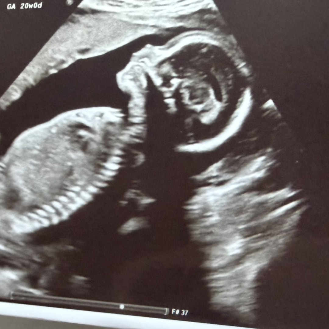 Photo shared by Jayla for their Babylist baby registry.