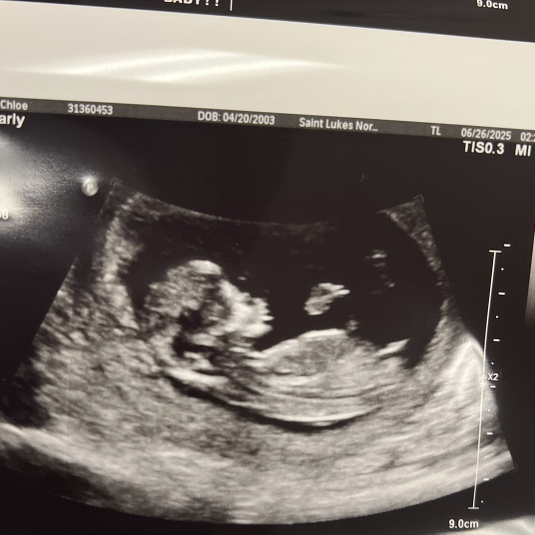 Photo shared by Chloe for their Babylist baby registry.