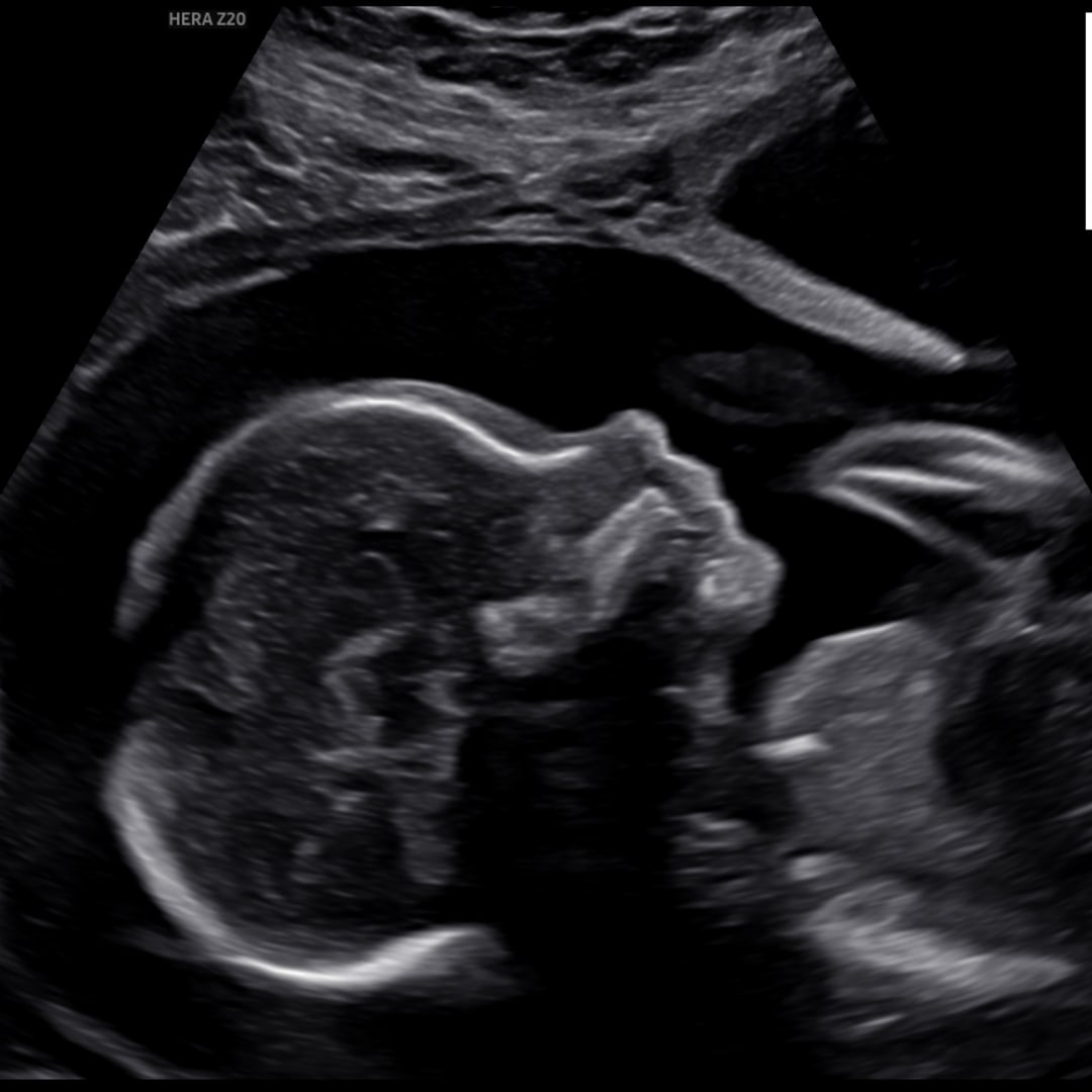 Photo shared by Cindi for their Babylist baby registry.
