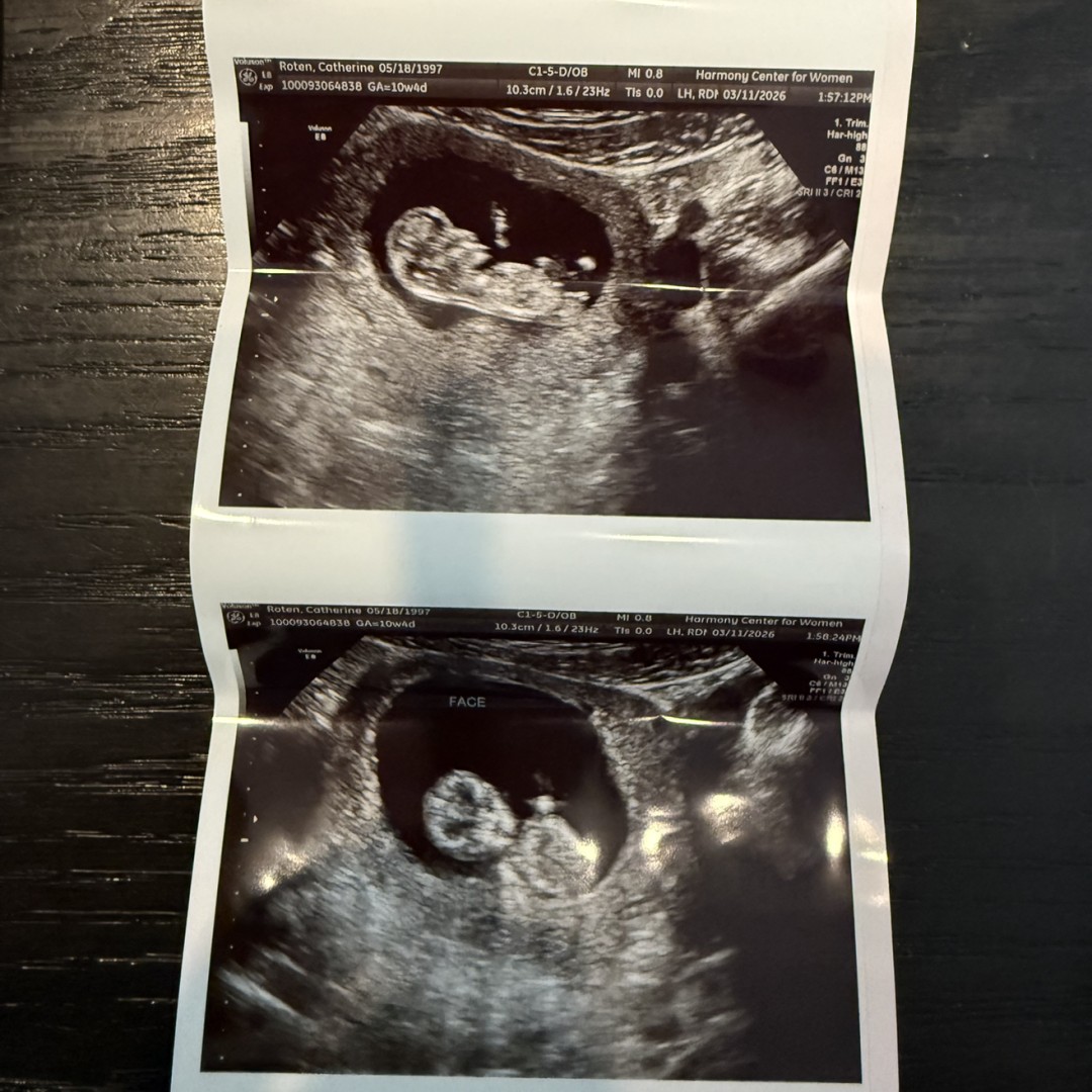 Photo shared by Catherine for their Babylist baby registry.