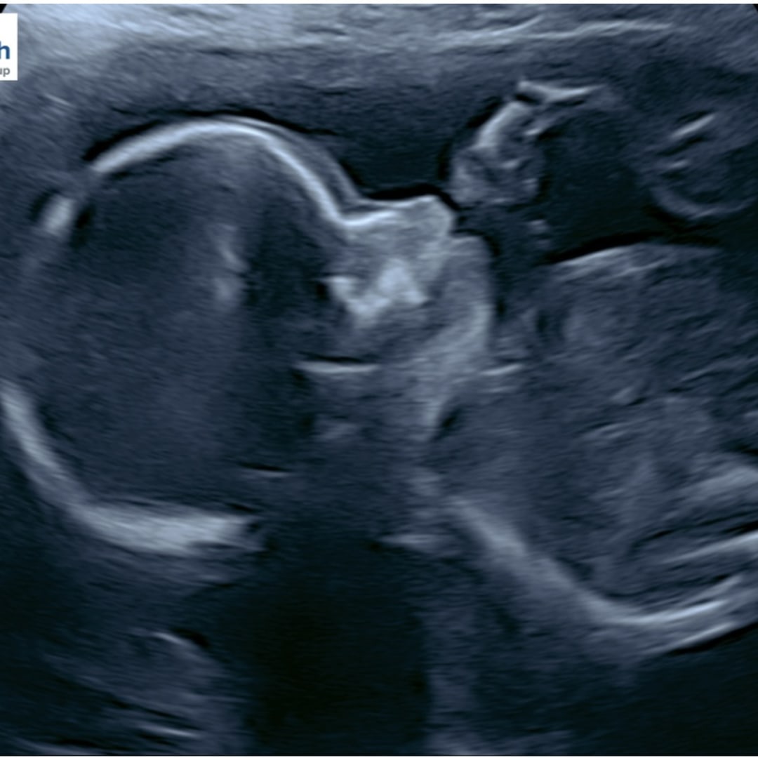 Photo shared by Connor for their Babylist baby registry.