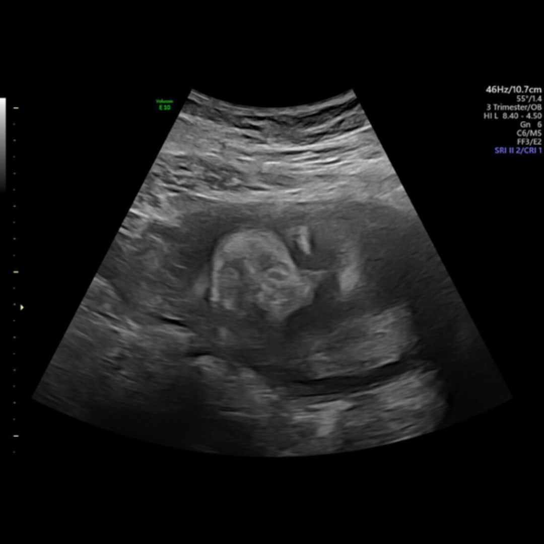 Photo shared by Meghan for their Babylist baby registry.