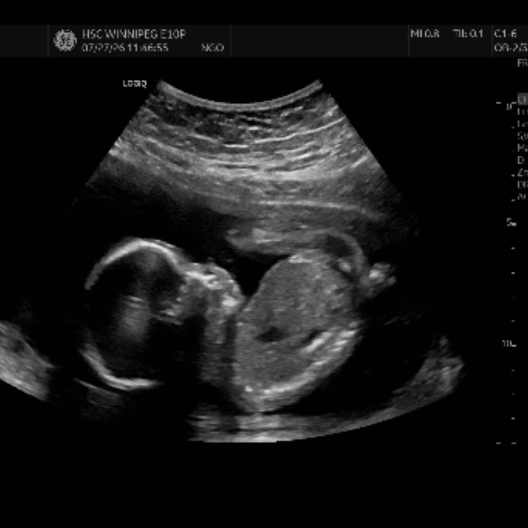 Photo shared by Sarah for their Babylist baby registry.