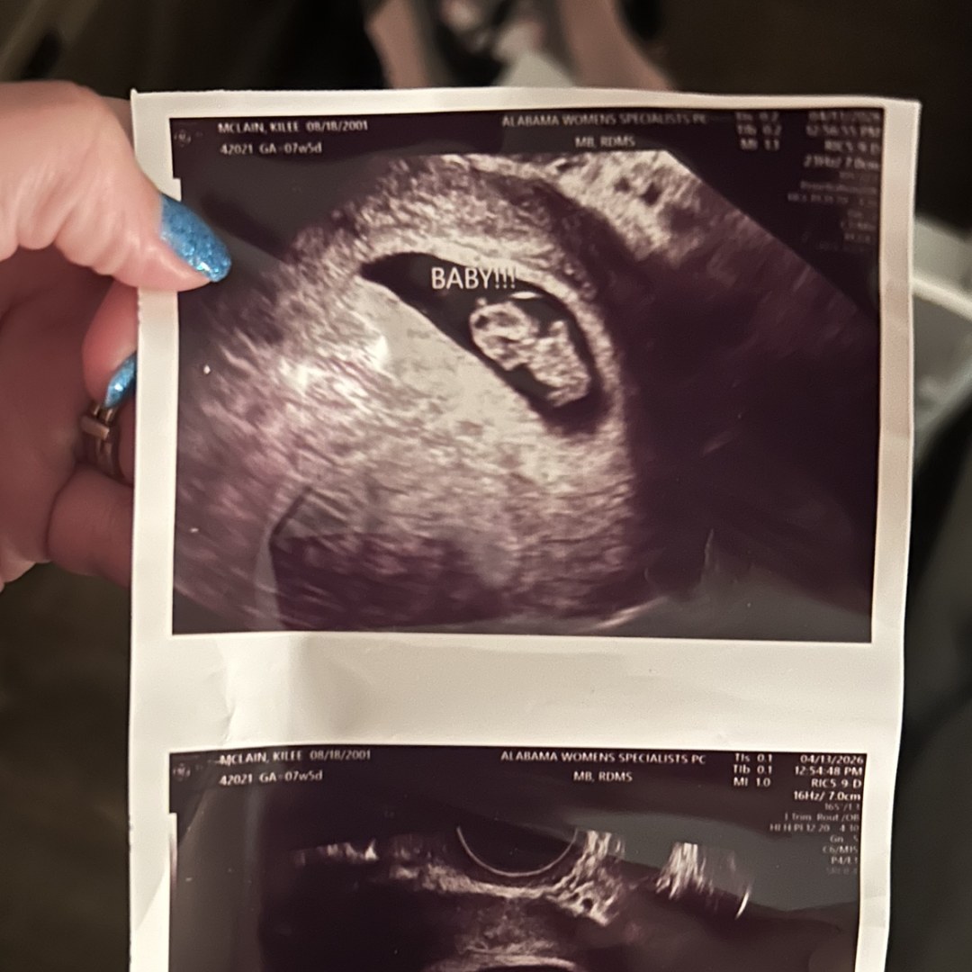 Photo shared by Kilee for their Babylist baby registry.
