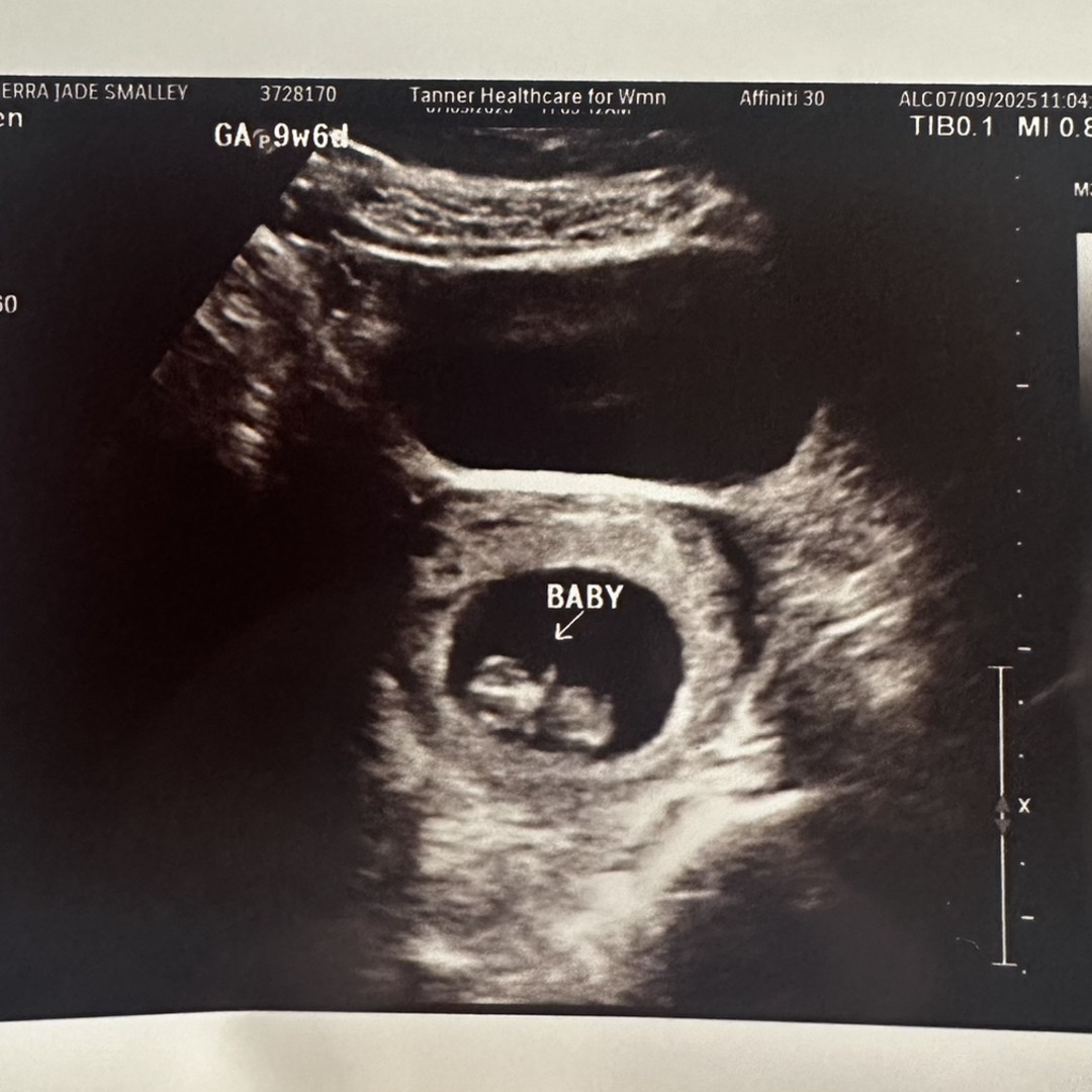 Photo shared by Sierra for their Babylist baby registry.