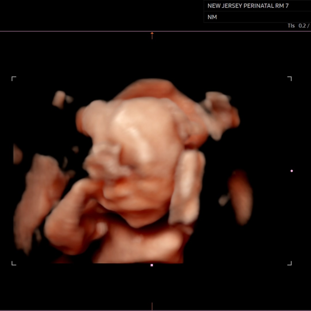 Photo shared by Rachel for their Babylist baby registry.