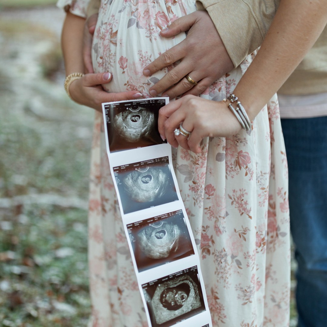 Photo shared by Randa for their Babylist baby registry.