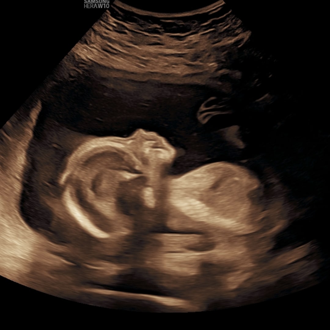 Photo shared by Delaney for their Babylist baby registry.