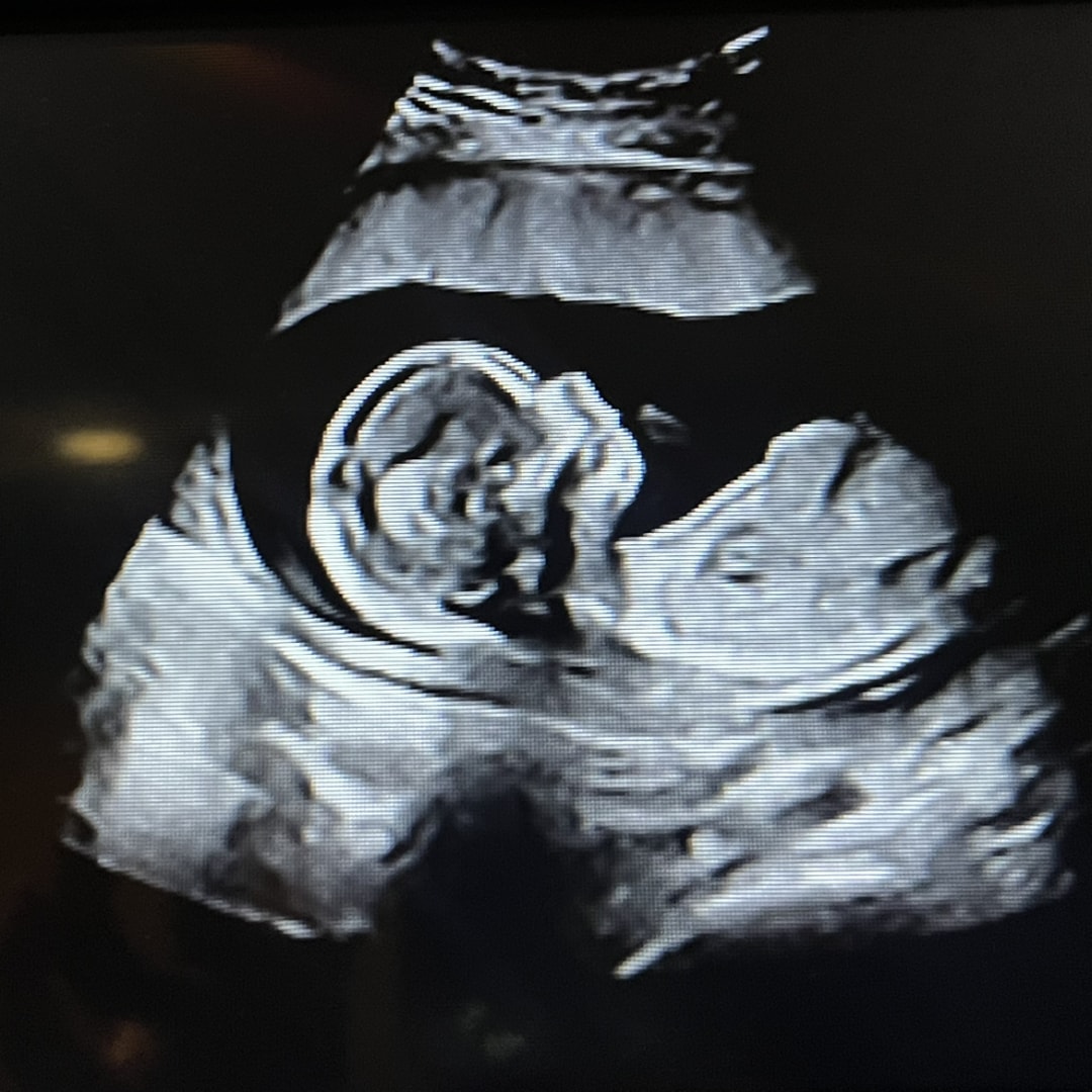 Photo shared by Monique for their Babylist baby registry.