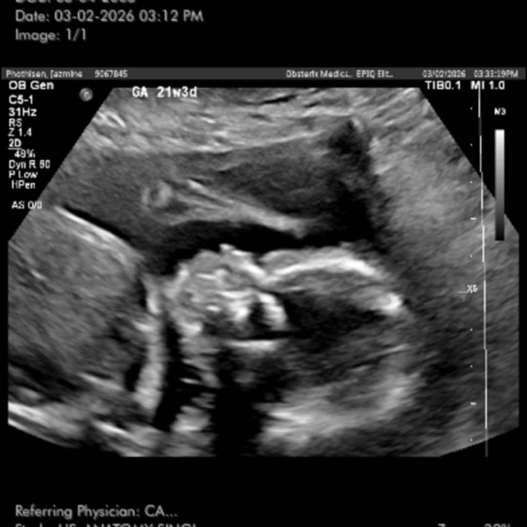 Photo shared by Jazmine for their Babylist baby registry.