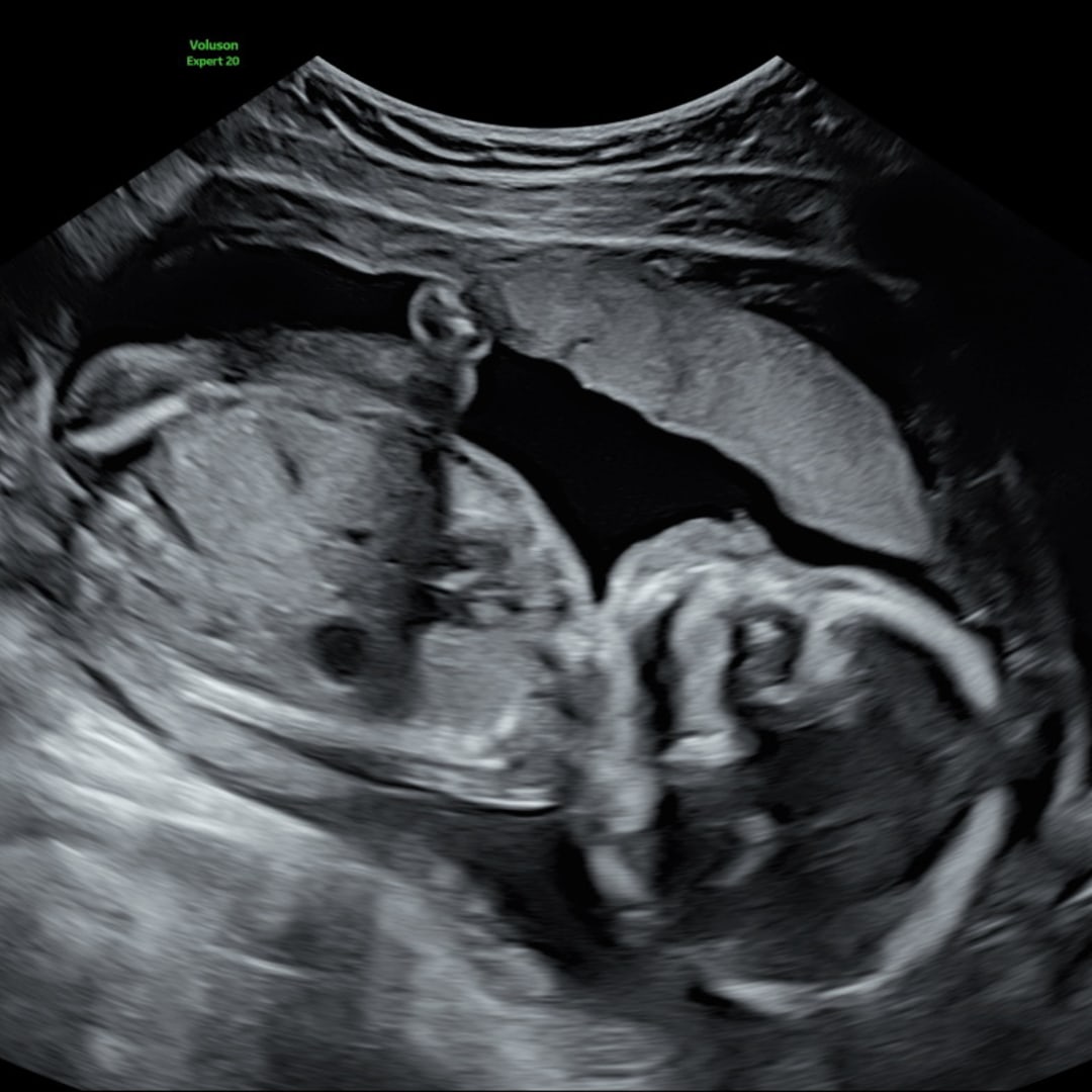 Photo shared by Kirslyn for their Babylist baby registry.