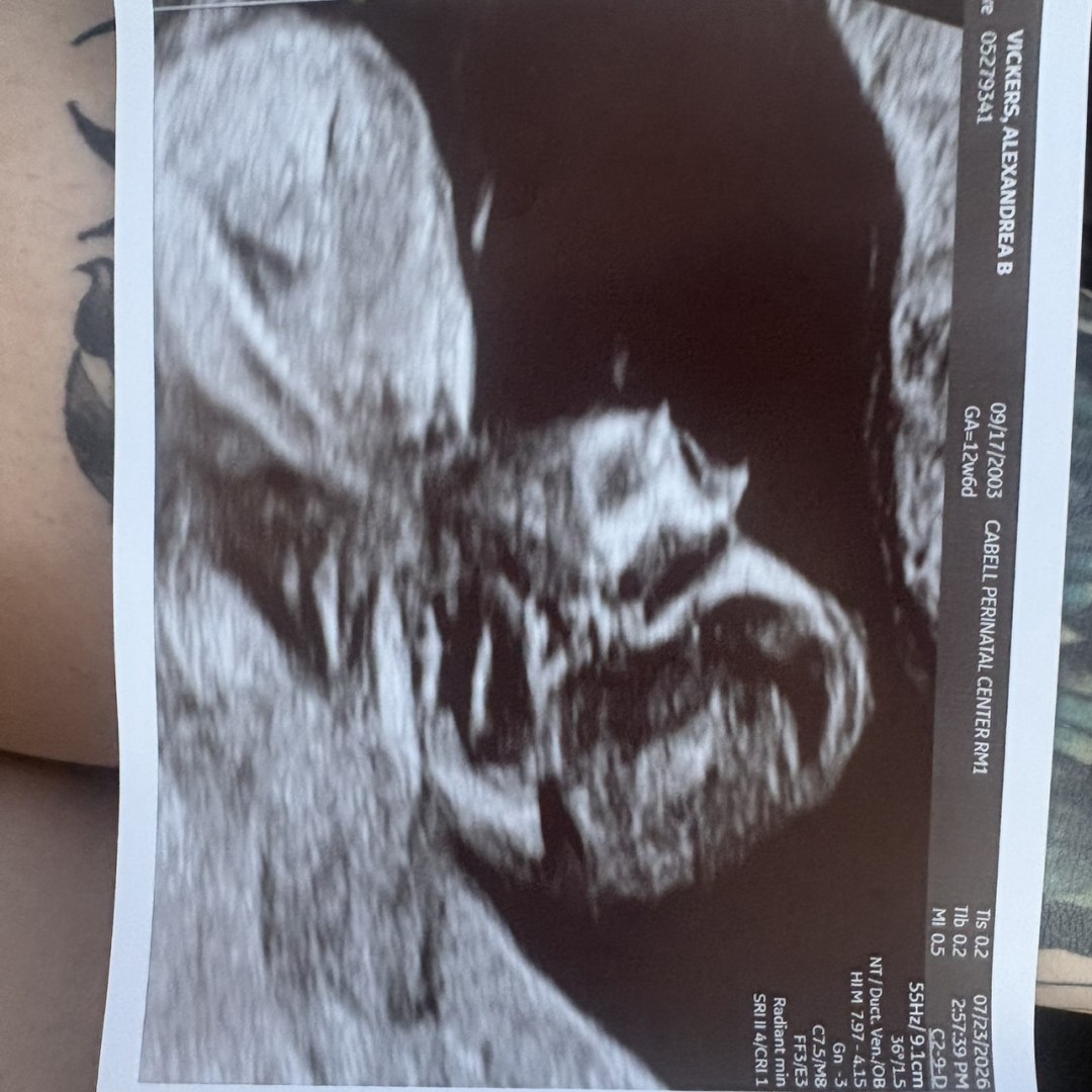 Photo shared by Alexandrea for their Babylist baby registry.