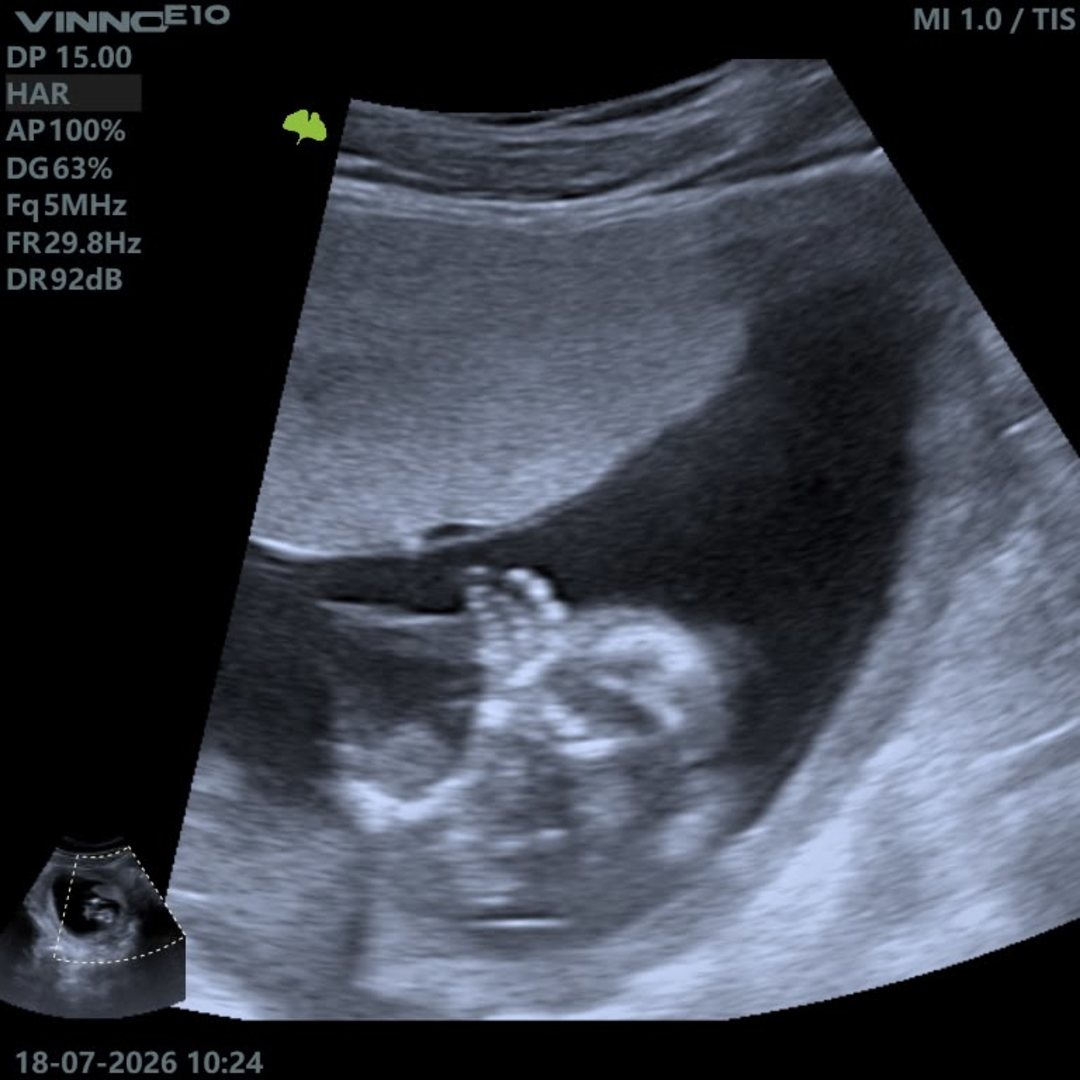 Photo shared by Danel for their Babylist baby registry.