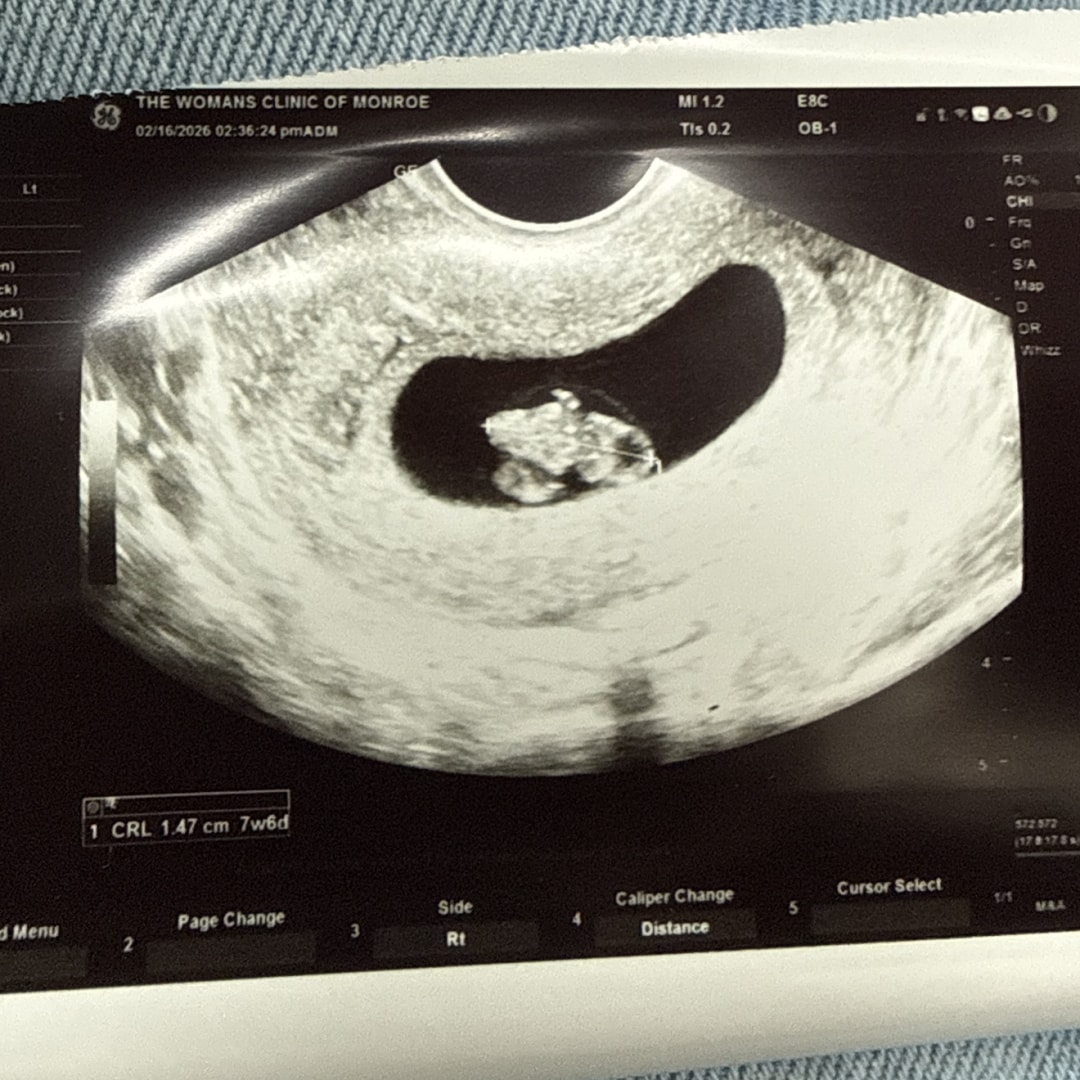 Photo shared by Alyssa for their Babylist baby registry.