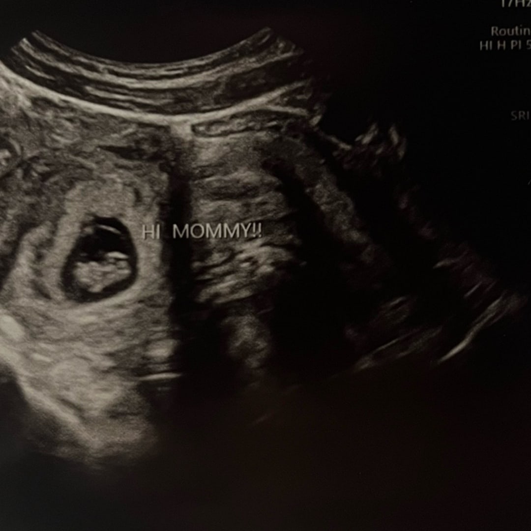 Photo shared by Kylah for their Babylist baby registry.