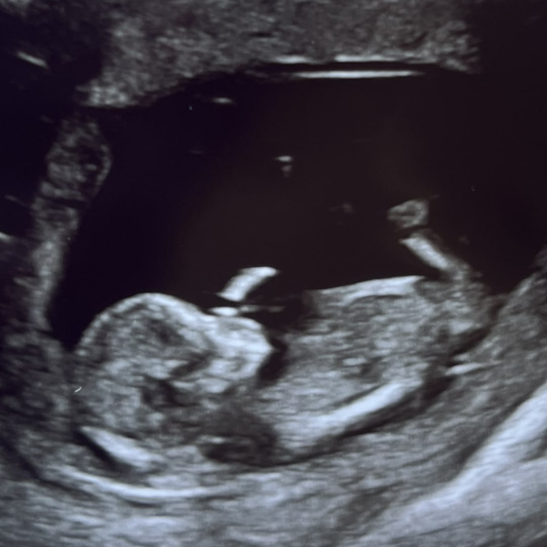 Photo shared by Brooklyn for their Babylist baby registry.