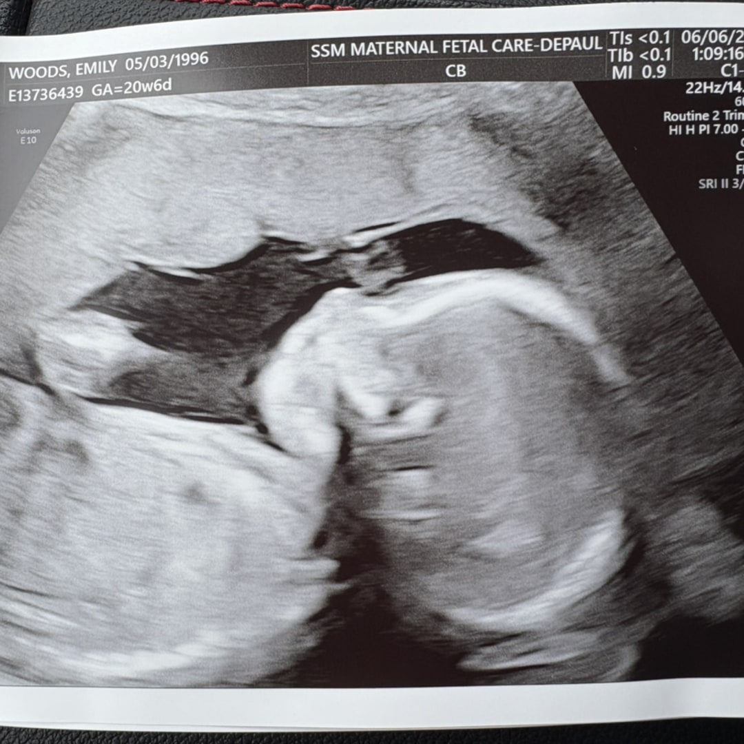 Photo shared by Emily for their Babylist baby registry.