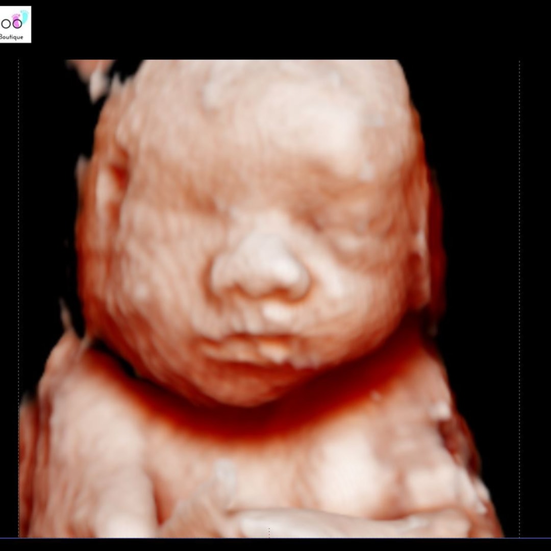 Photo shared by Lexi for their Babylist baby registry.