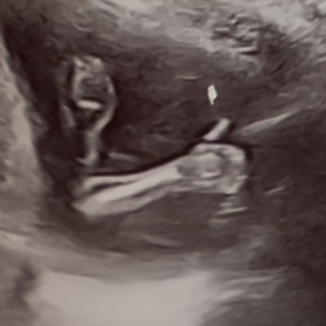 Photo shared by Maranda for their Babylist baby registry.