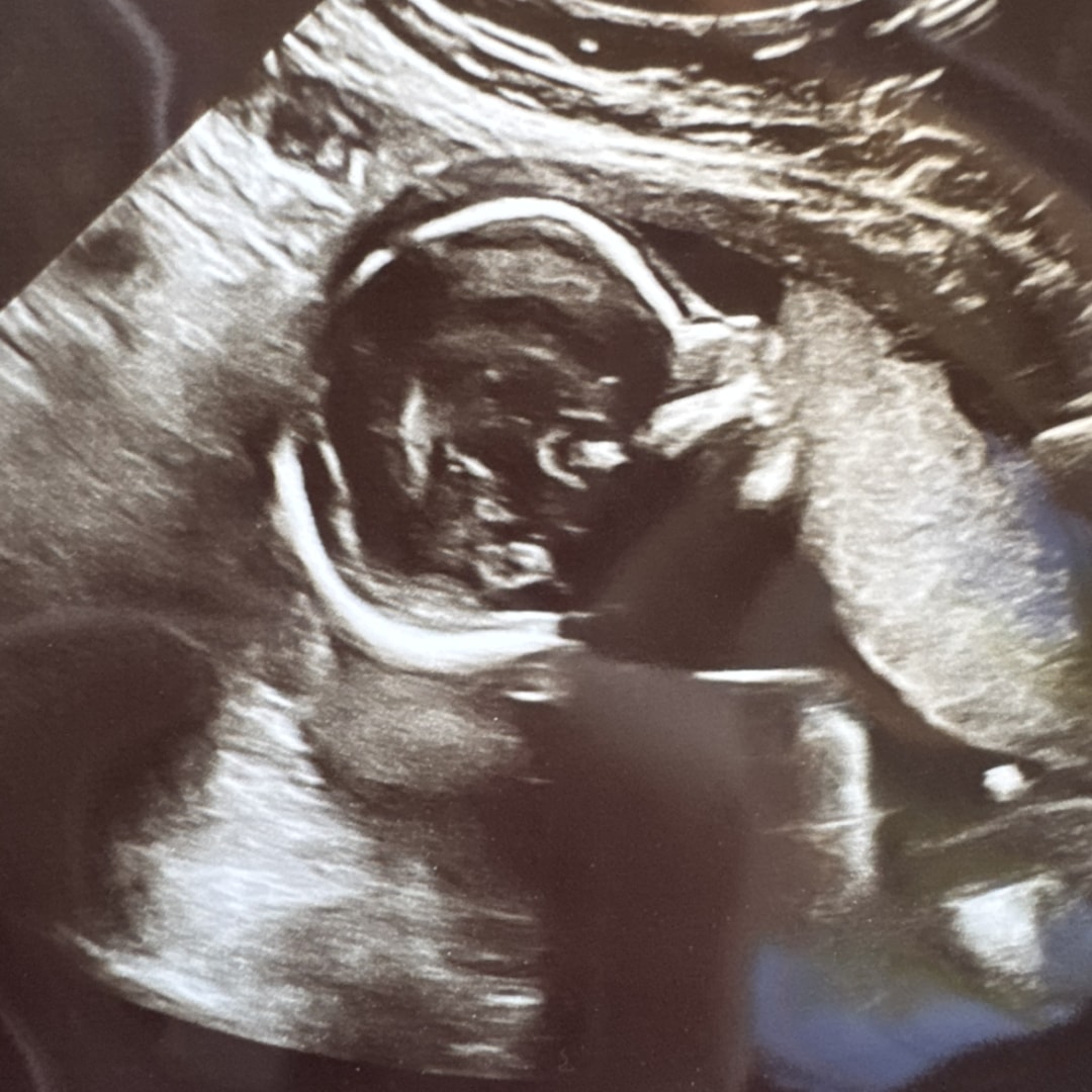 Photo shared by Jillian for their Babylist baby registry.
