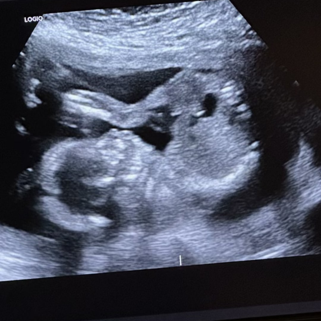 Photo shared by Kati for their Babylist baby registry.