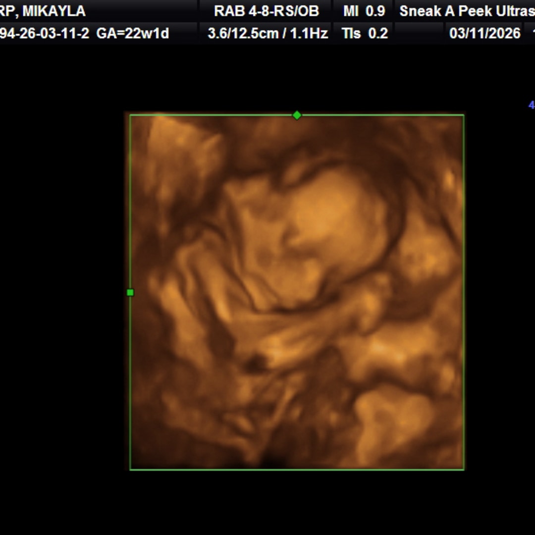 Photo shared by Mikayla for their Babylist baby registry.