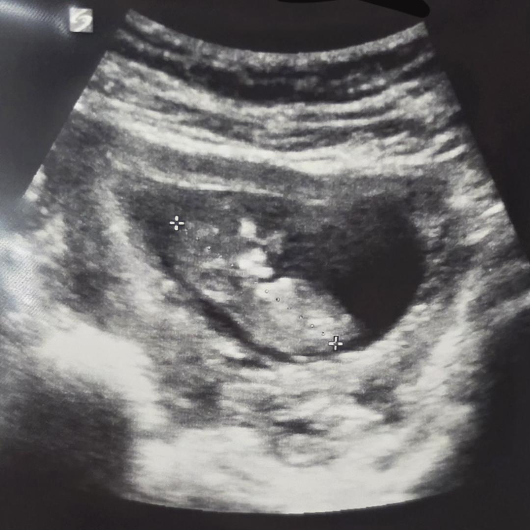 Photo shared by LaiLeAna for their Babylist baby registry.