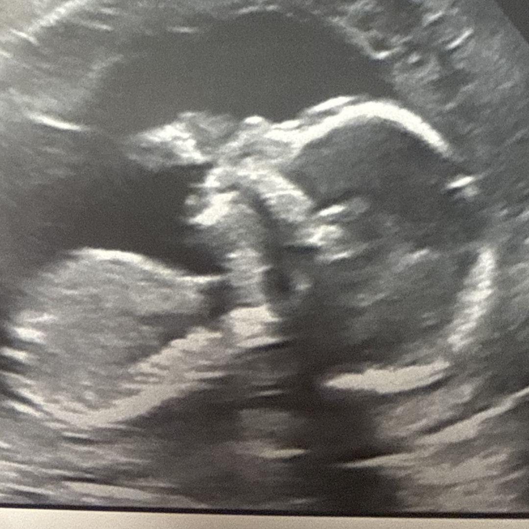 Photo shared by Taylor for their Babylist baby registry.