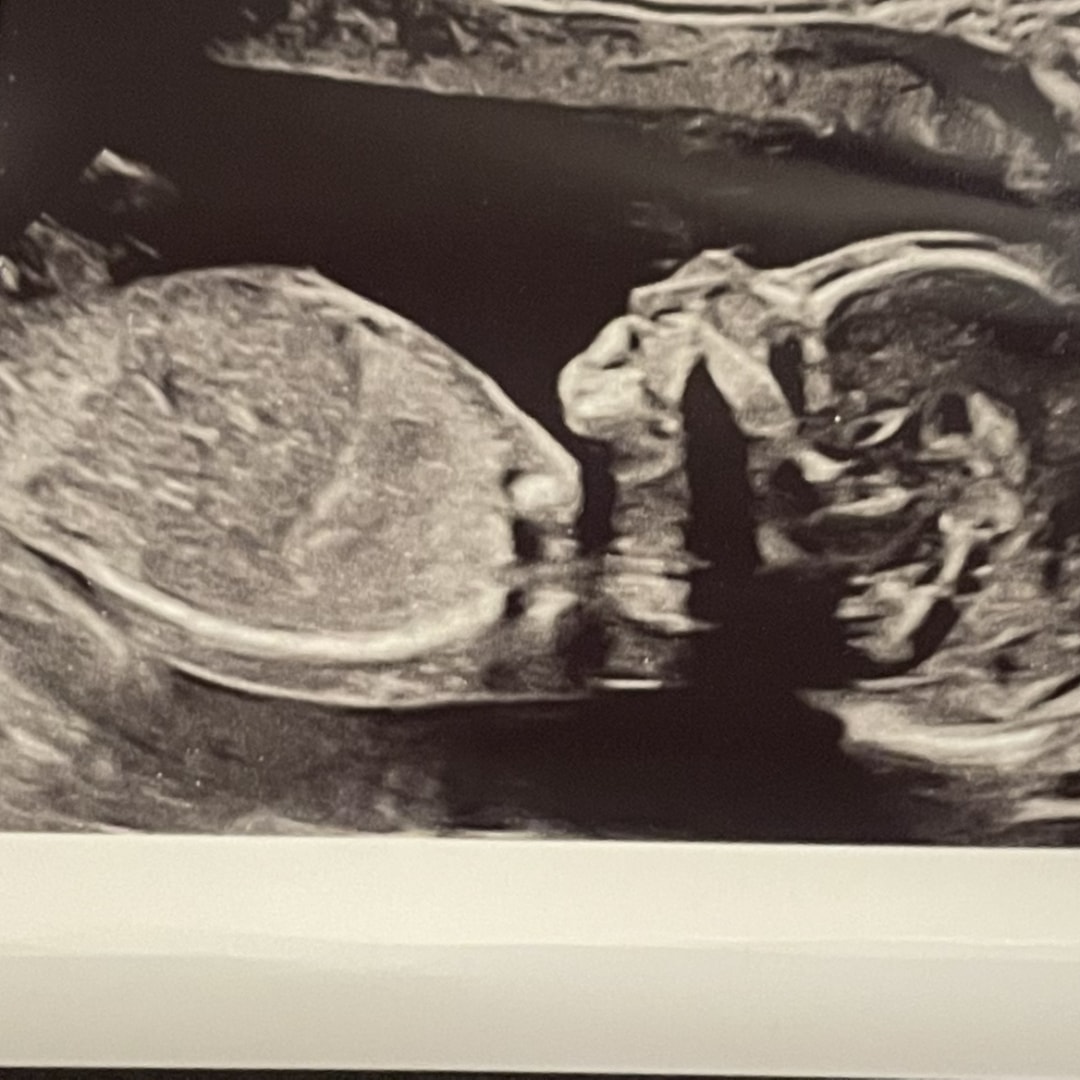Photo shared by Rachel for their Babylist baby registry.