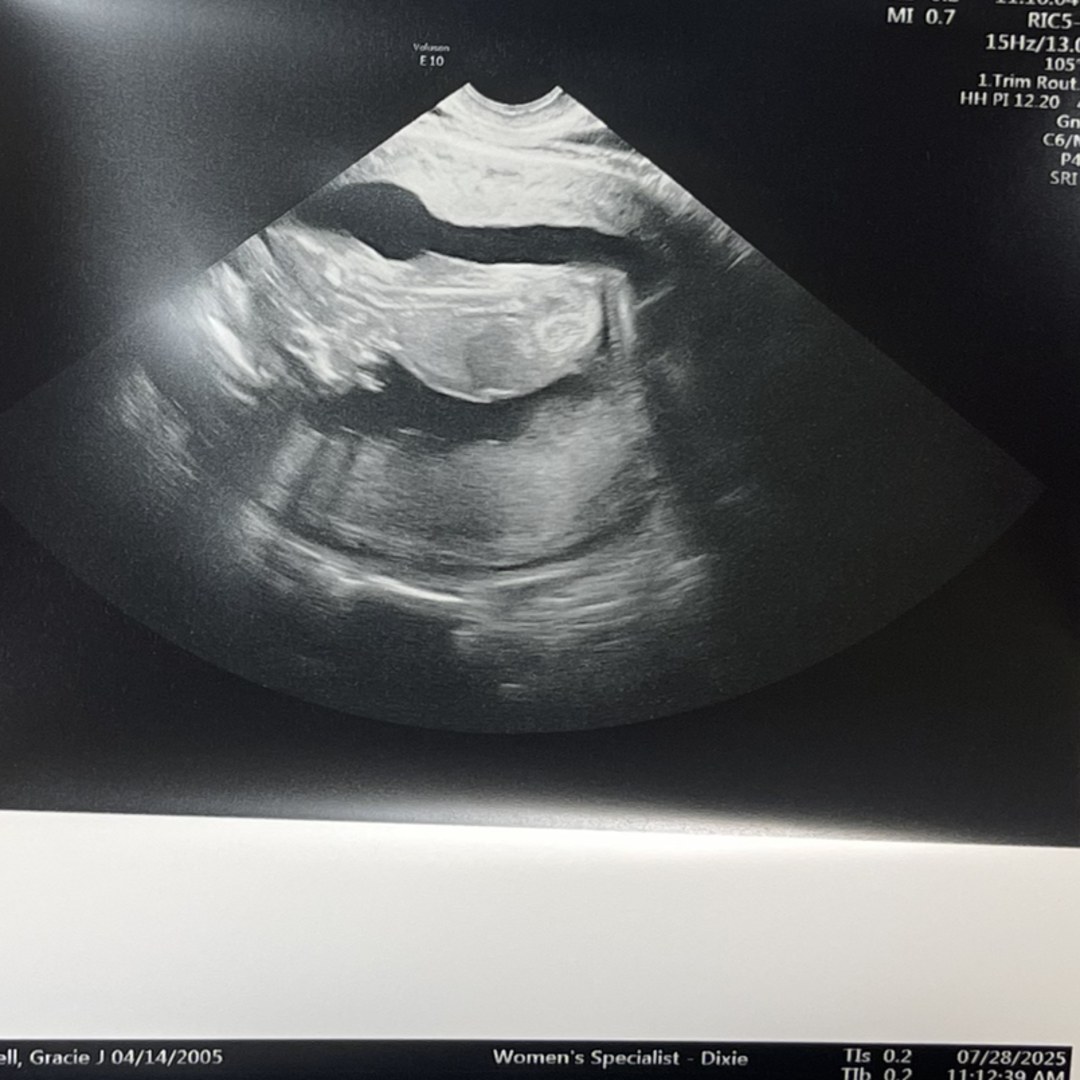 Photo shared by Gracie for their Babylist baby registry.