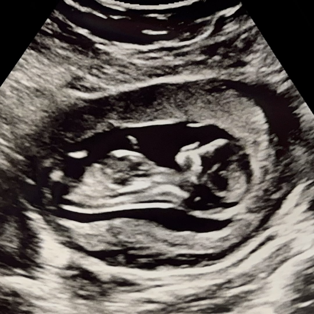 Photo shared by Julia for their Babylist baby registry.