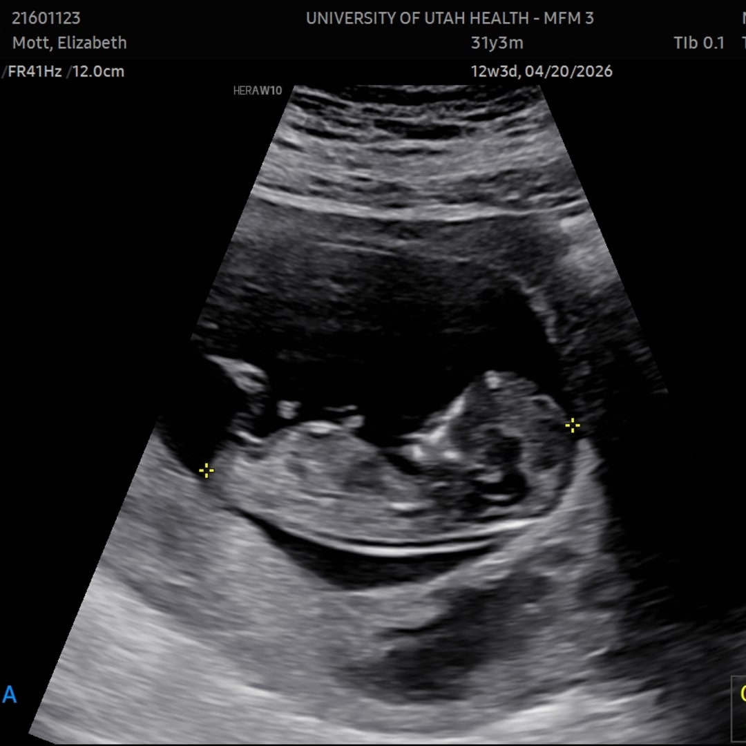 Photo shared by Elizabeth for their Babylist baby registry.