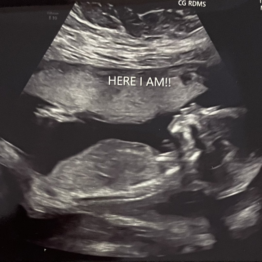 Photo shared by Christina for their Babylist baby registry.