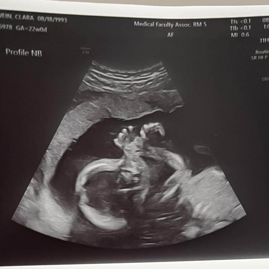 Photo shared by Clara for their Babylist baby registry.