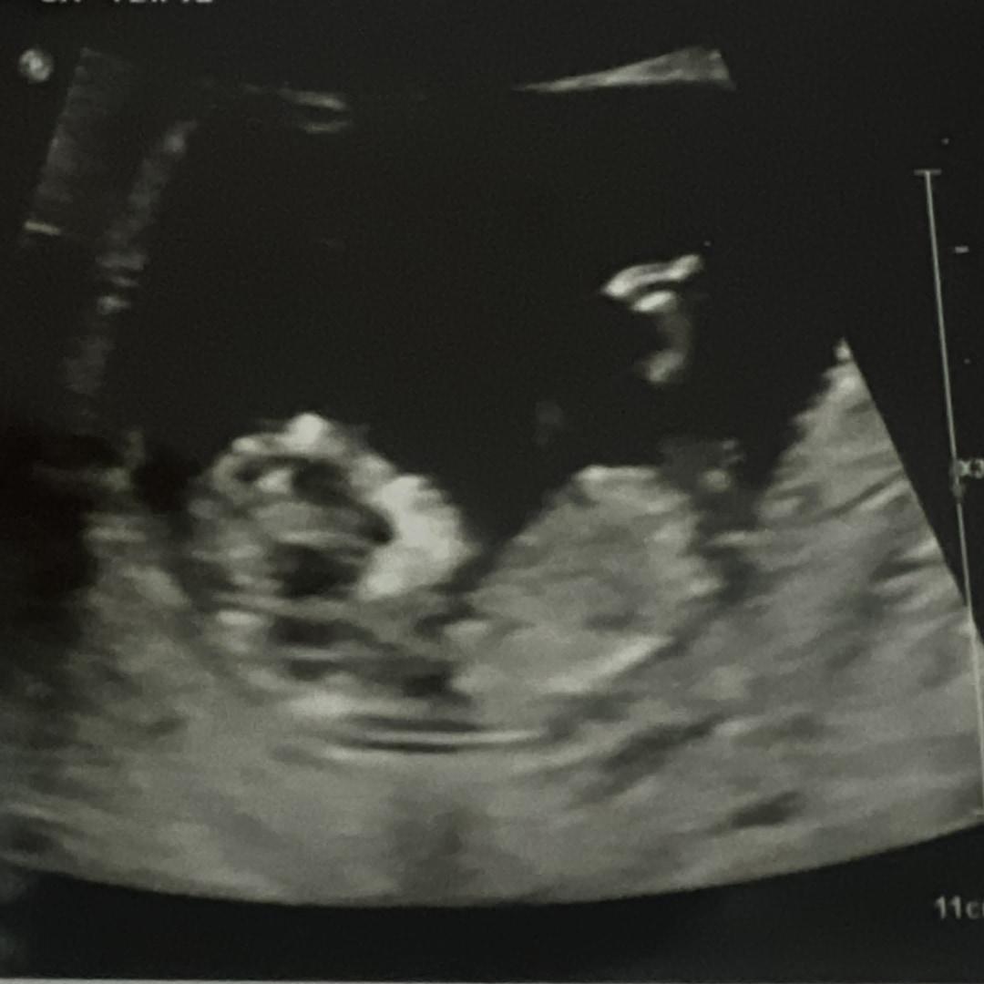 Photo shared by Brittany for their Babylist baby registry.