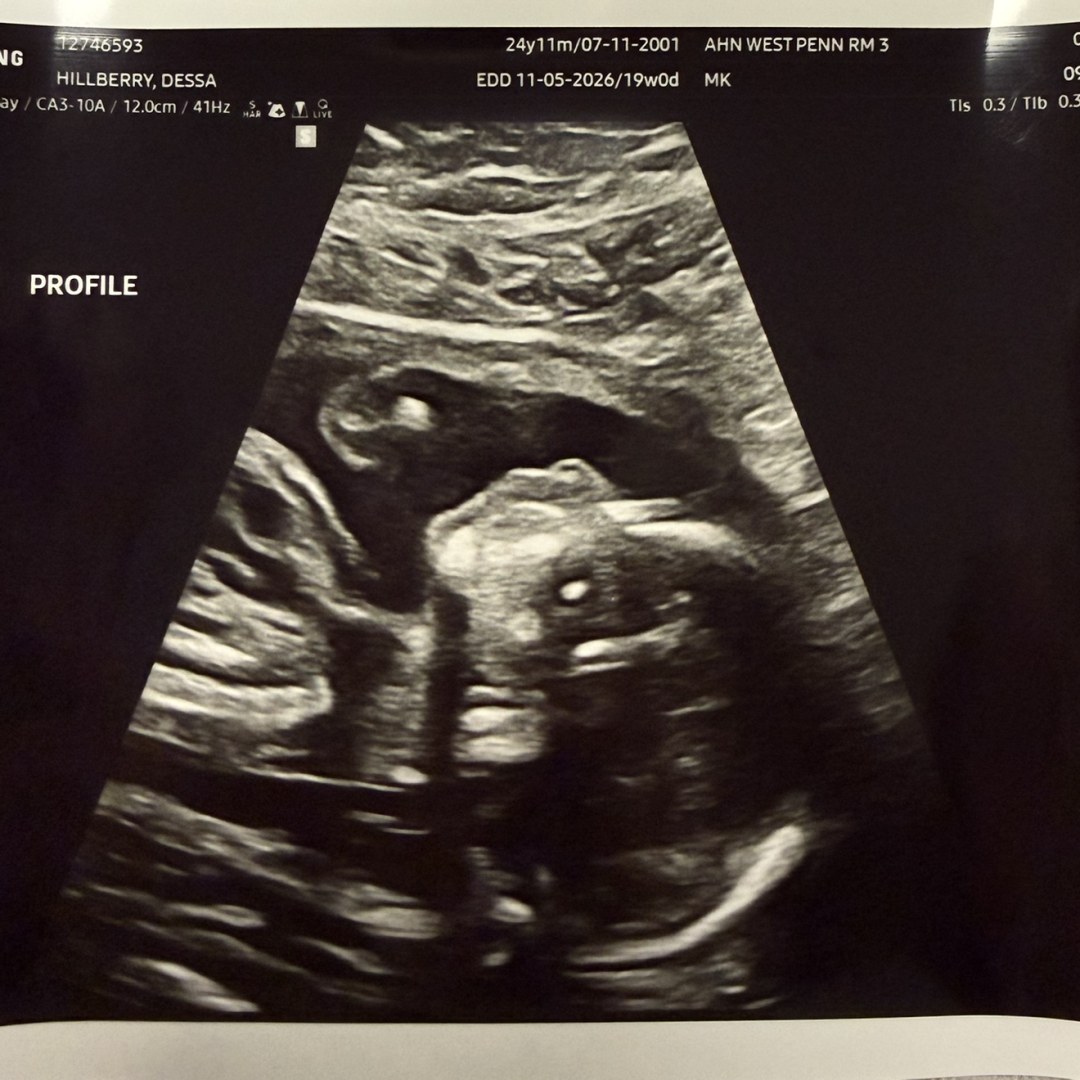 Photo shared by Dessa for their Babylist baby registry.
