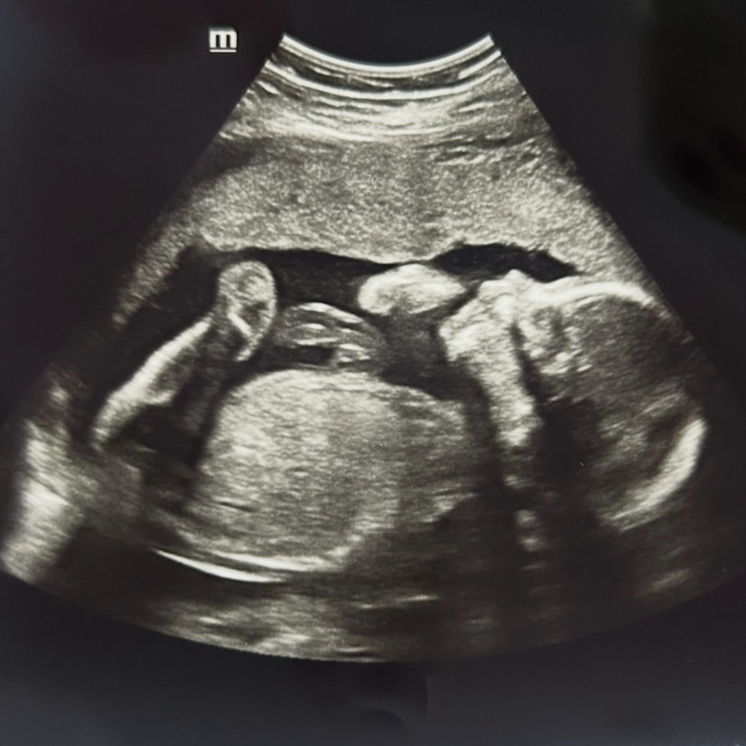 Photo shared by Brin for their Babylist baby registry.