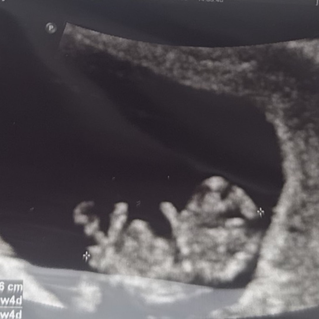 Photo shared by Andrea for their Babylist baby registry.