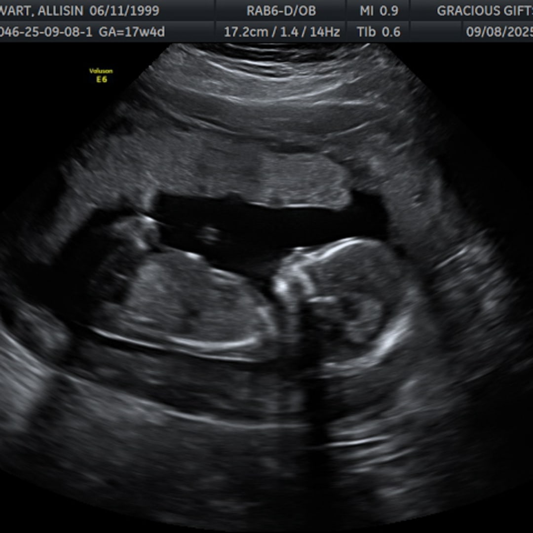 Photo shared by Allisin for their Babylist baby registry.