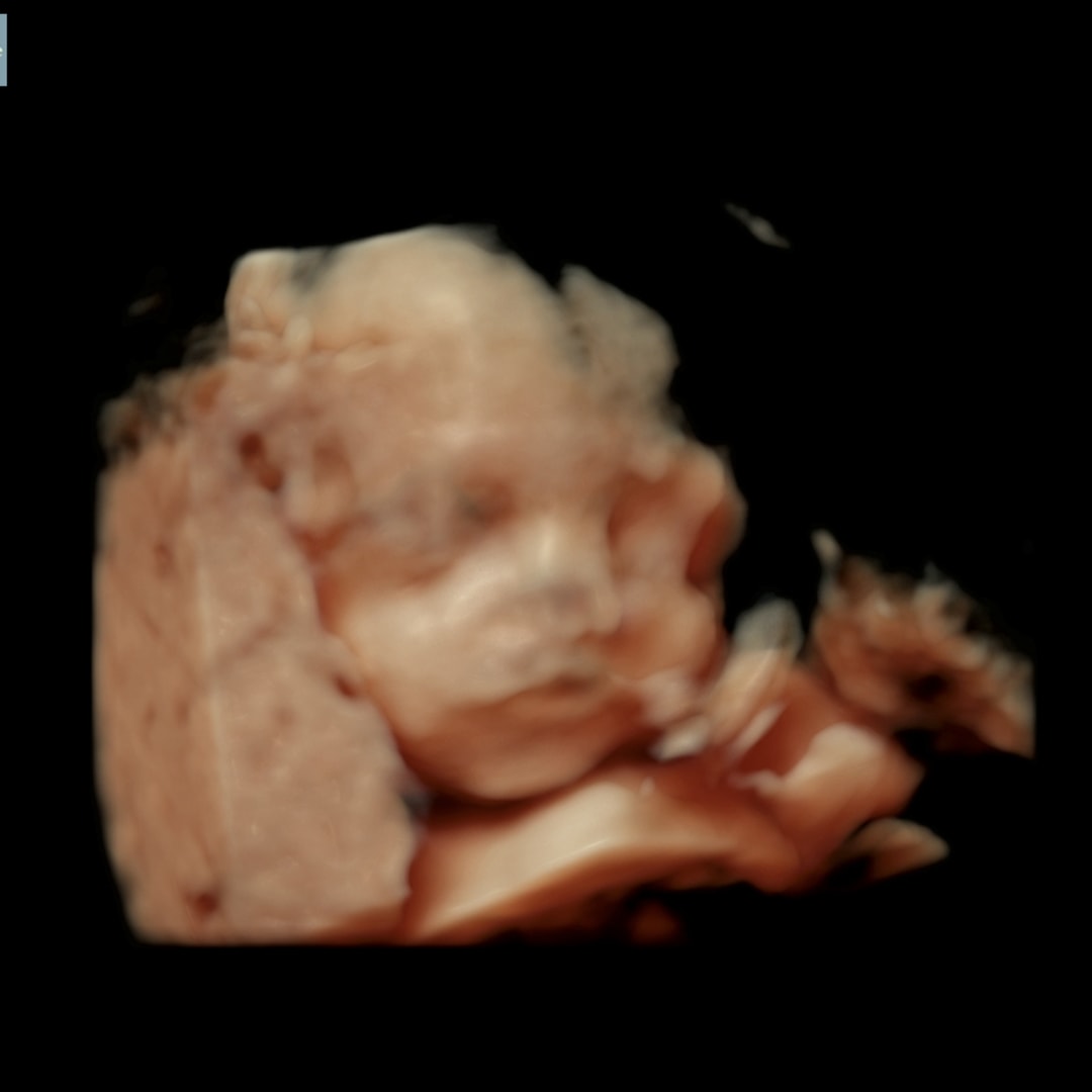 Photo shared by Karla for their Babylist baby registry.