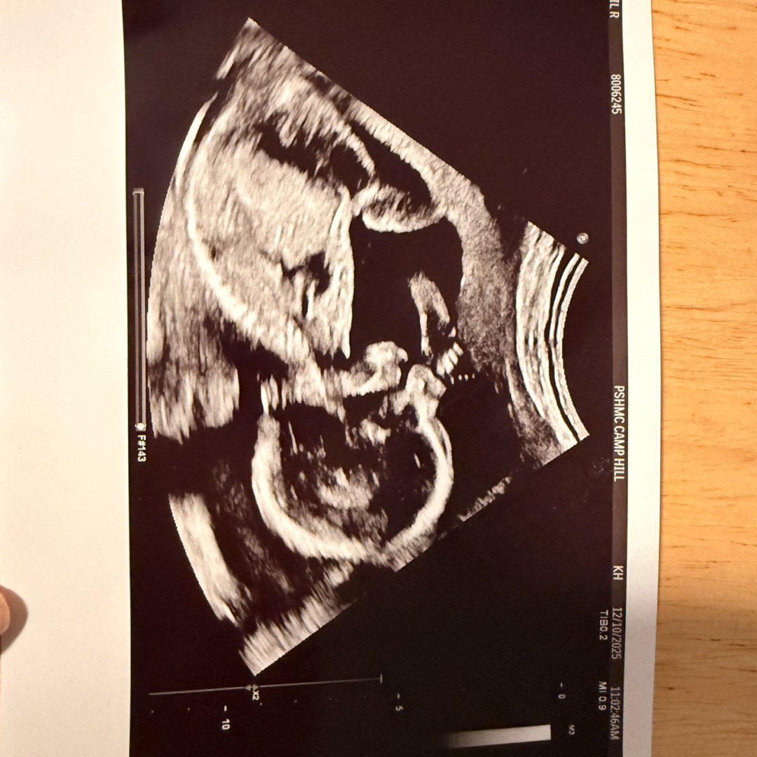 Photo shared by Abby for their Babylist baby registry.