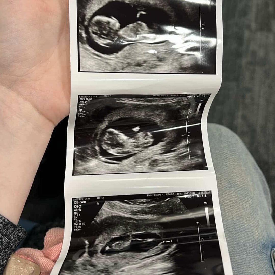 Photo shared by Brandon for their Babylist baby registry.