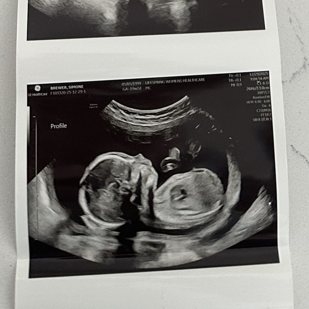 Photo shared by Simone for their Babylist baby registry.