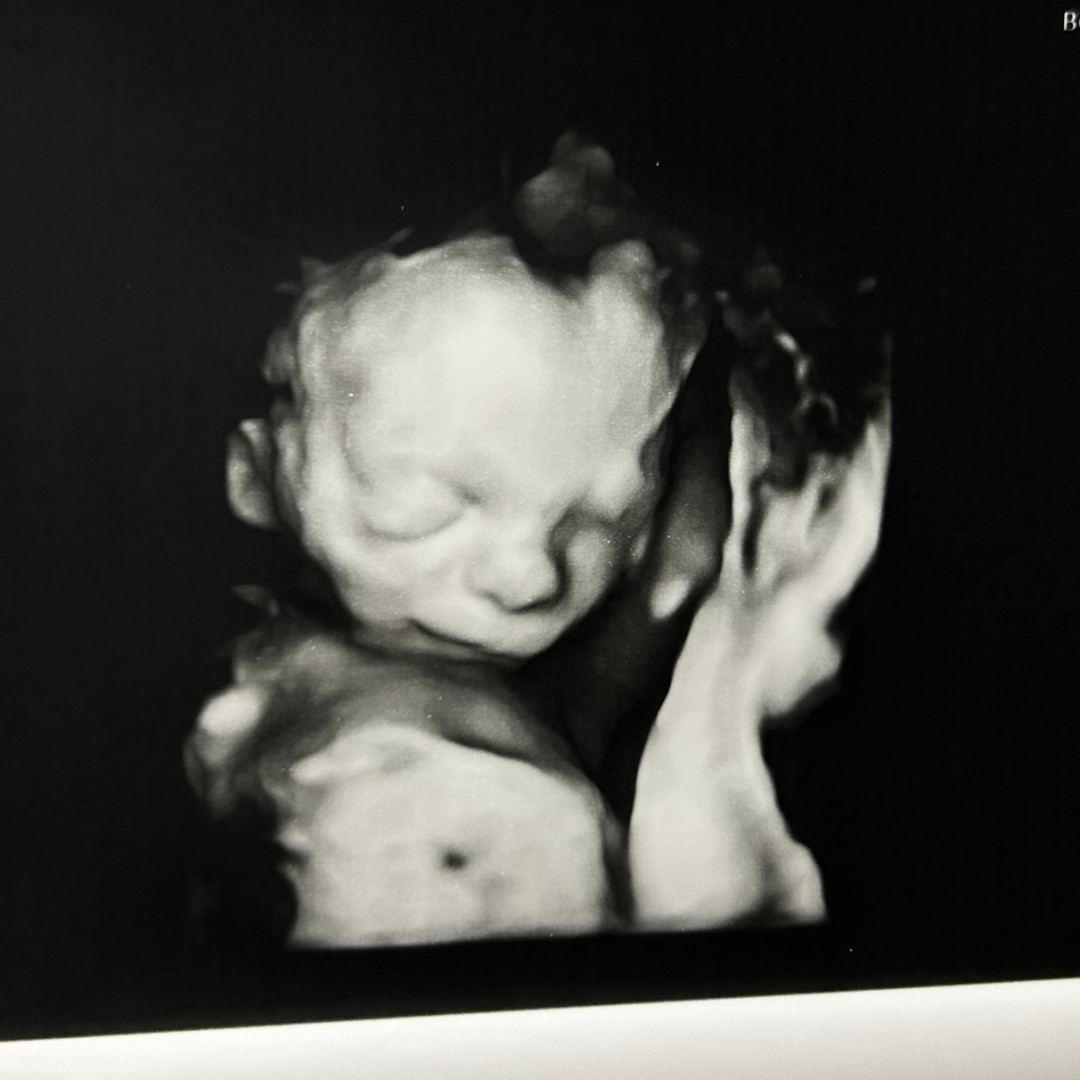 Photo shared by Echo for their Babylist baby registry.